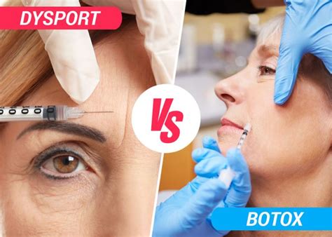 dysport|dysport vs azzalure.